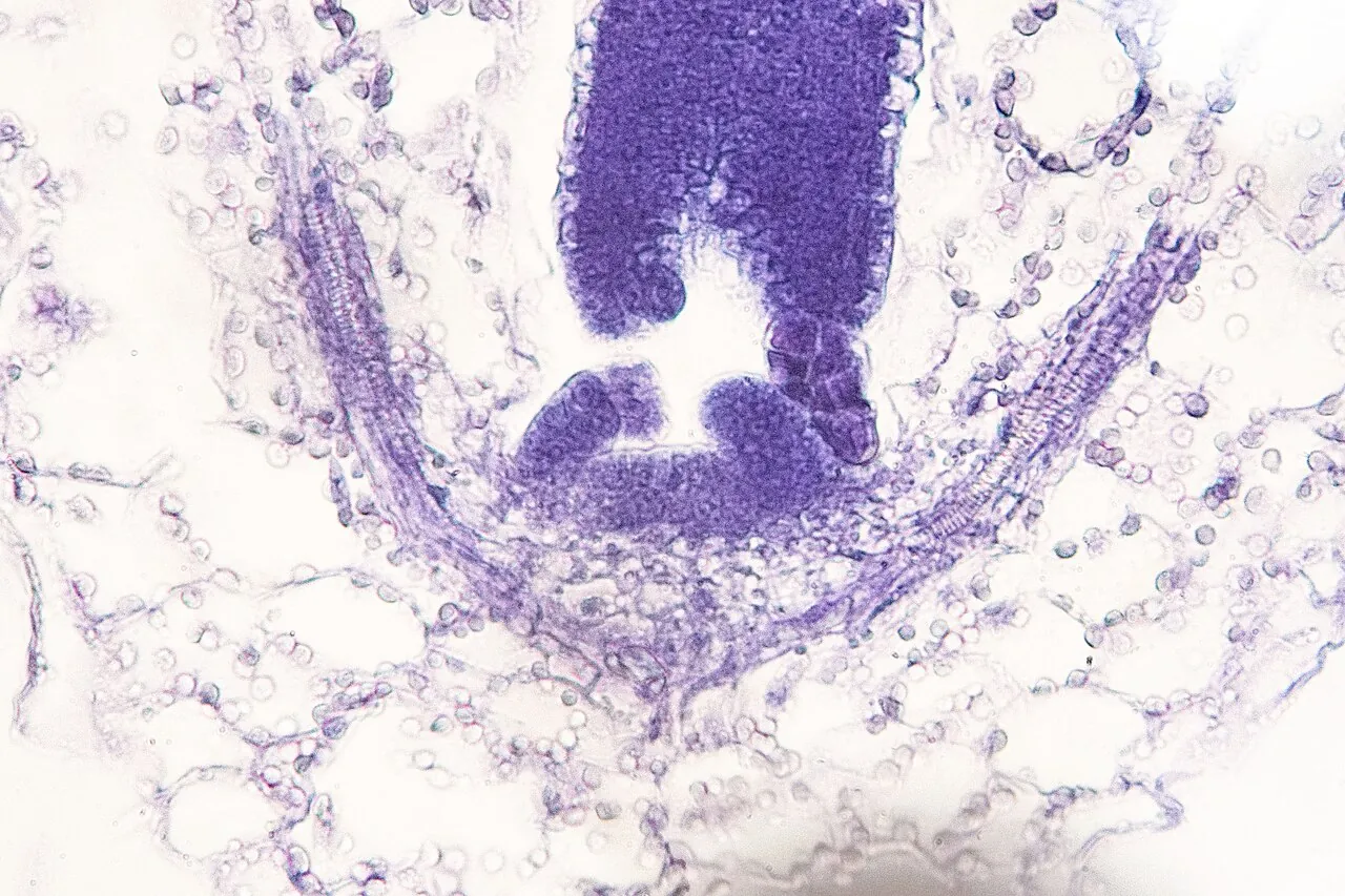 Апікальна меристема пагона Arabidopsis thaliana на зрізі: купол меристеми й примордії